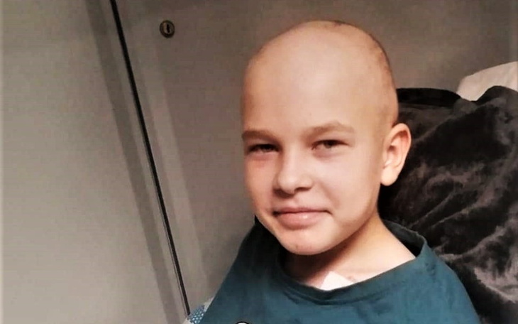 Chłopiec z łysą głową, uśmiechający się w szpitalu.