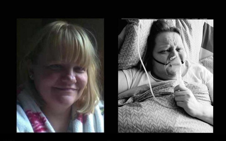 Porównanie dwóch zdjęć kobiety, jedno z uśmiechem, drugie w szpitalu.