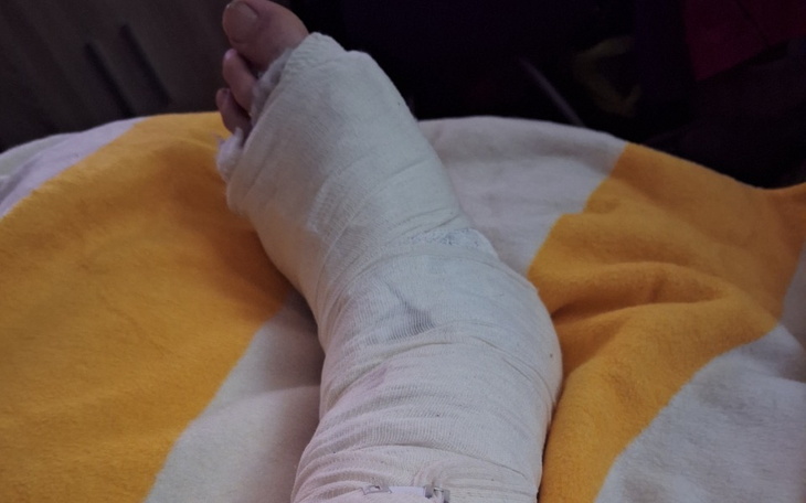 Zbiórka Zbieram na operacje nogi . - zdjęcie główne