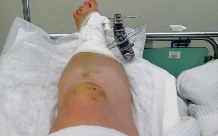 Zbiórka Operacja - przeszczep - zdjęcie główne