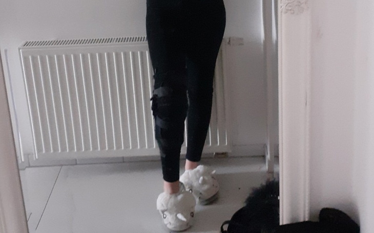 Zbiórka Trochleoplastyka kolana - zdjęcie główne