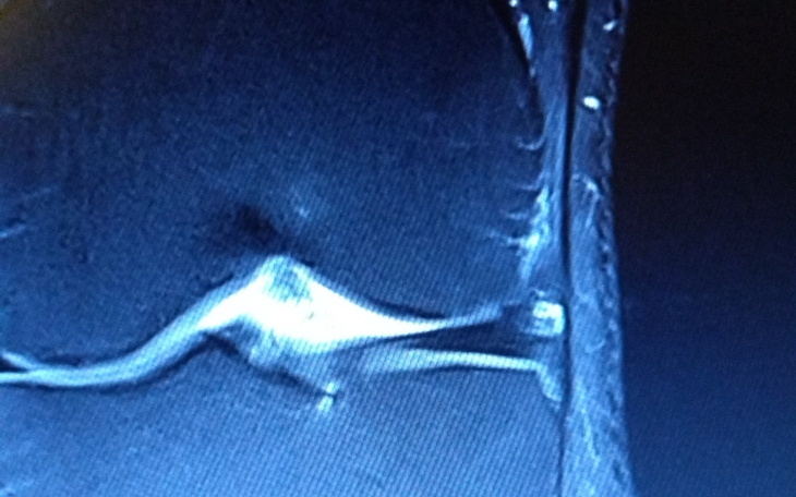 Obraz z MRI, przedstawiający szczegóły anatomiczne.