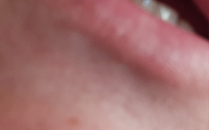 Zbiórka Szczery usmiech - zdjęcie główne