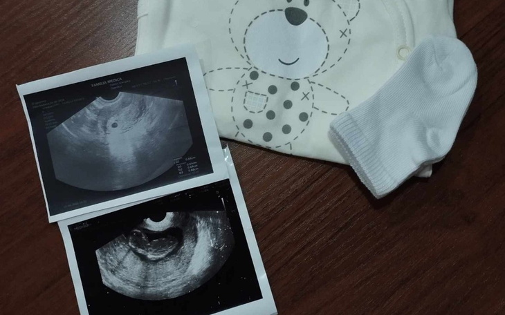 Zbiórka Dla nienarodzonego dziecka - zdjęcie główne