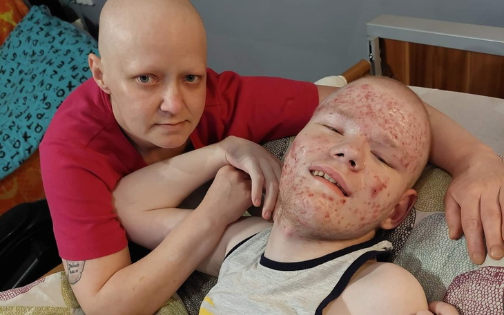 Zbiórka Podwójna walka o życie - zdjęcie główne