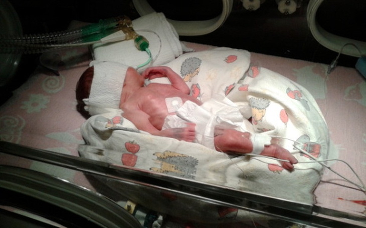 Zbiórka Pomoc w rehabilitacji Ani - zdjęcie główne