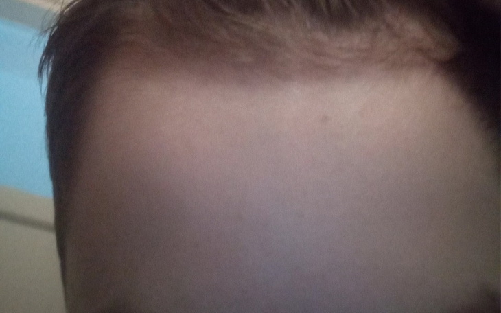 Zbiórka Zbieram na rehabilitację ego - zdjęcie główne