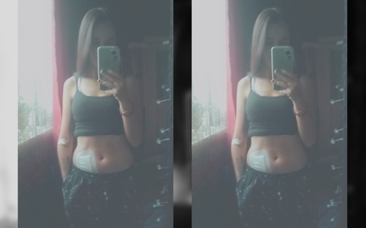 Młoda kobieta z opatrunkiem na brzuchu, robiąca selfie.