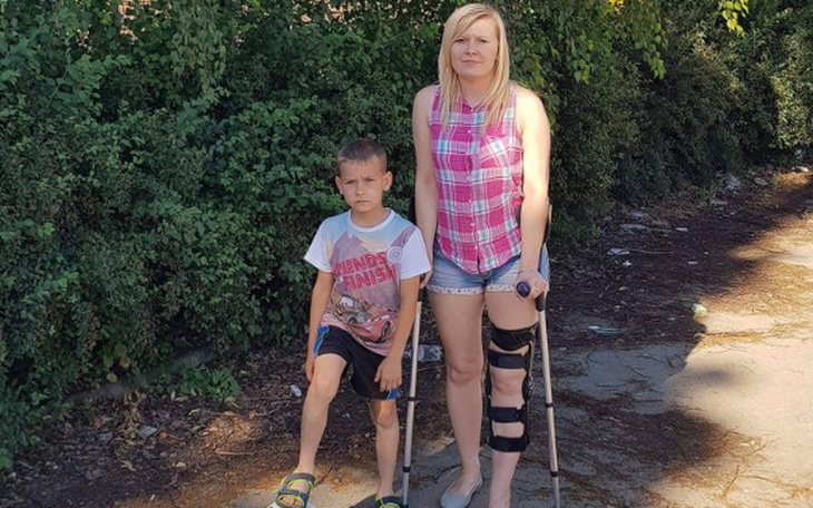 Zbiórka Operacja i rehabilitacja dla Agi - zdjęcie główne