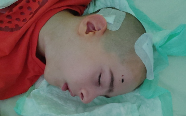 Zbiórka Pilna operacja I chodzik - zdjęcie główne
