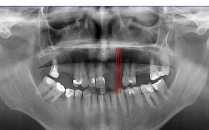 Zbiórka Operacje kości żuchwy i szczęki - zdjęcie główne