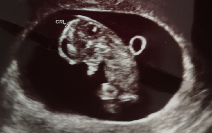 Zbiórka Walka o lepsze życie dla synka - zdjęcie główne