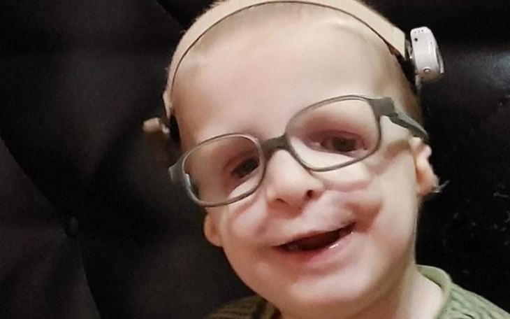 Zbiórka Rekonstrukcja uszy u dziecka - zdjęcie główne