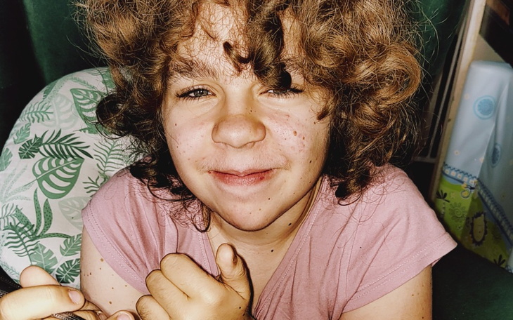 Zbiórka Piękny uśmiech Oli, - zdjęcie główne