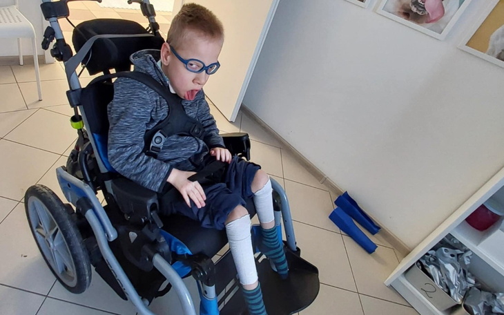 Chłopiec w wózku inwalidzkim, z językiem na wierzchu.