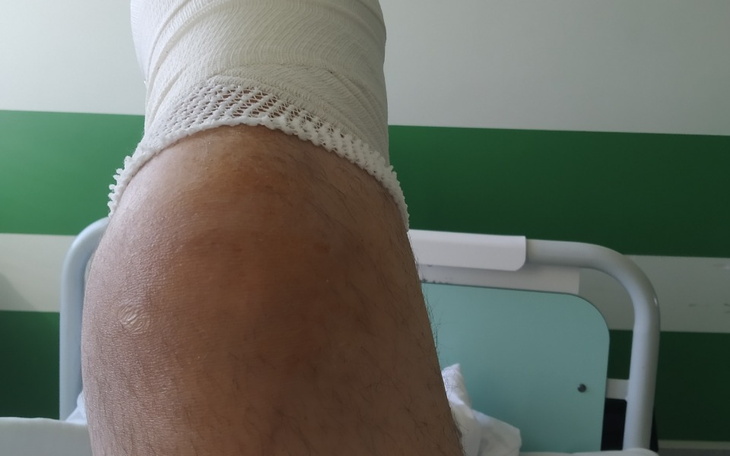 Zbiórka Proteza nogi wózek elektryczny r - zdjęcie główne