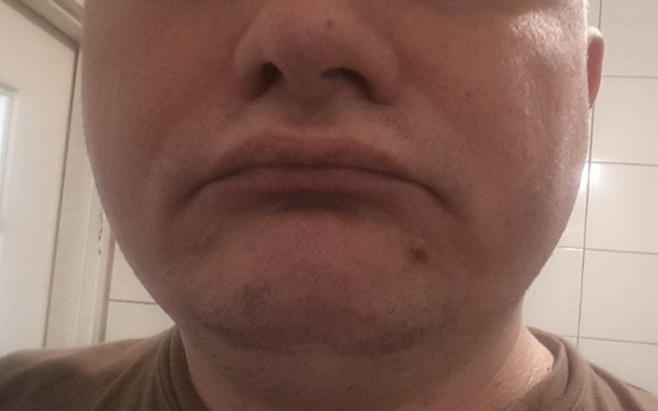 Zbiórka Przywróć uśmiech i sens życia - zdjęcie główne