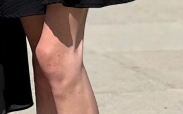 Zbiórka Wolne i piękne życie - zdjęcie główne