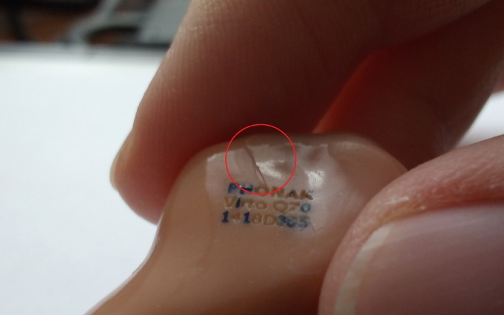 Zbiórka Aparat słuchowy dla Janusza - zdjęcie główne