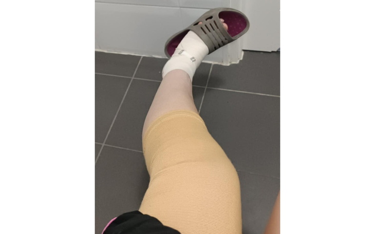 Noga z opatrunkiem, w sandałach, na tle łazienki.