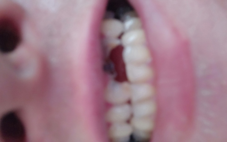 Zbiórka Pomóżcie odzyskać uśmiech - zdjęcie główne