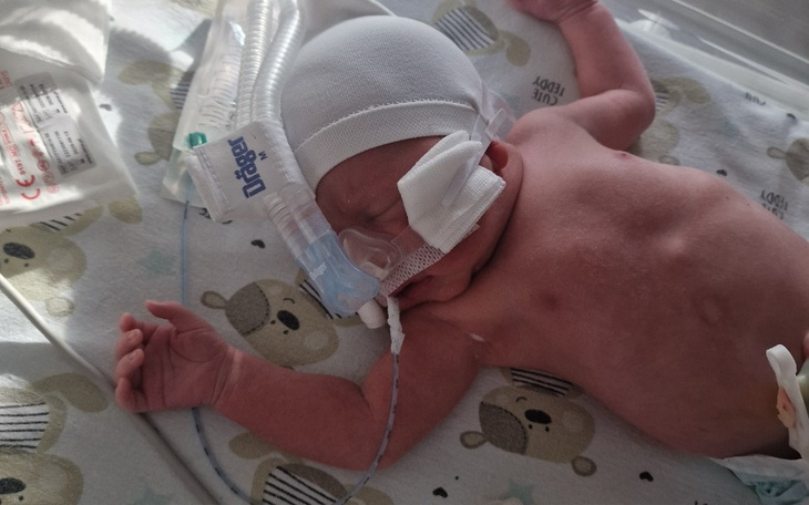 Noworodek w inkubatorze z rurkami tlenowymi.