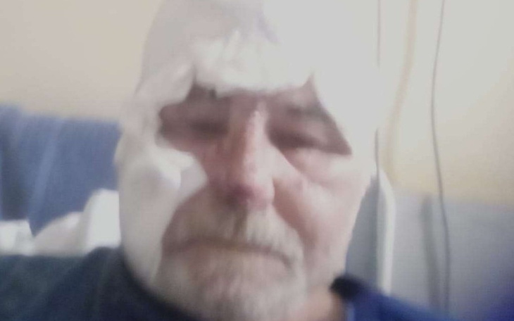Mężczyzna z opatrunkiem na głowie w szpitalu.