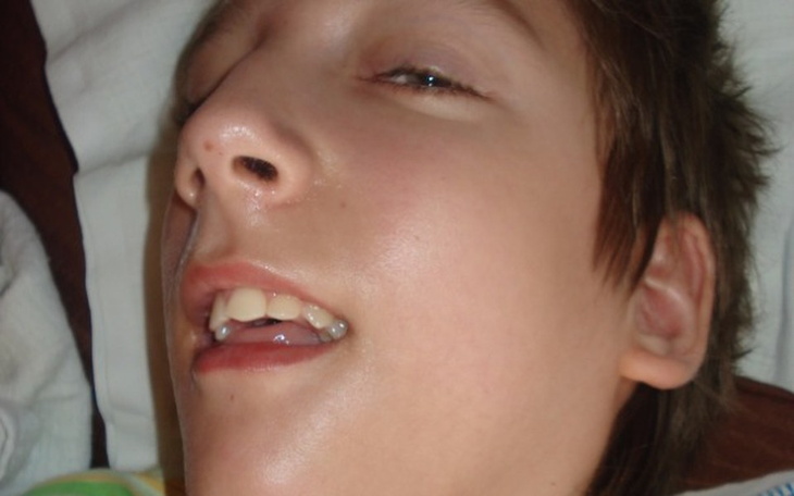 Zbiórka Zbieram na rehabilitację - zdjęcie główne