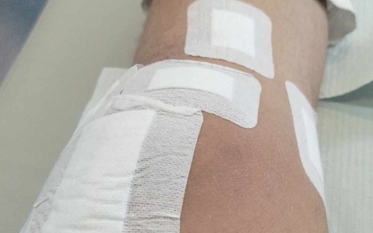 Zbliżenie na opatrunki na nodze, widoczne rany.