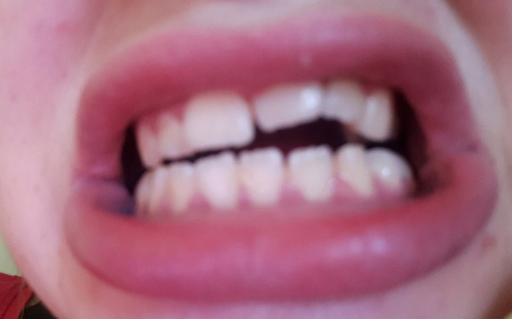 Zbiórka Leczenie zębów +( aparat na zęby - zdjęcie główne