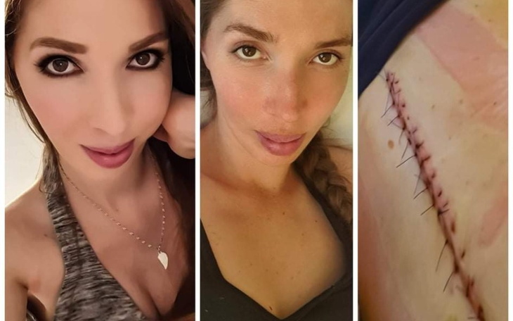 Zbiórka Powrót do zdrowia Moniki. - zdjęcie główne