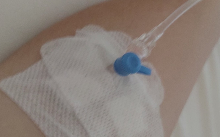 Zdjęcie ręki z opatrunkiem i wkłuciem dożylanym.