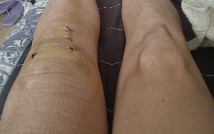 Zbiórka Pomoc na powrót na parkiet - zdjęcie główne