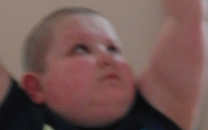 Zbiórka Bieżnia rehabilitacyjna dla Jasi - zdjęcie główne