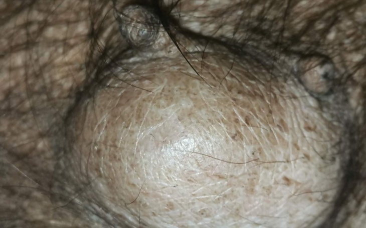 Zbiórka Wycięcie guza suczki z pseudo - zdjęcie główne