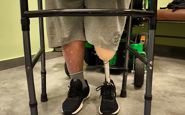 Zbiórka PROTEZA teraz rehabilitacja - zdjęcie główne