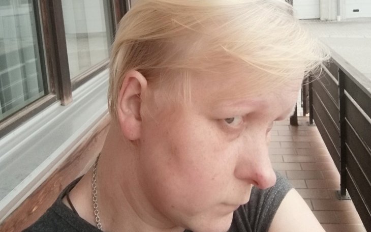 Zbiórka Na spłatę długów dla Anni - zdjęcie główne