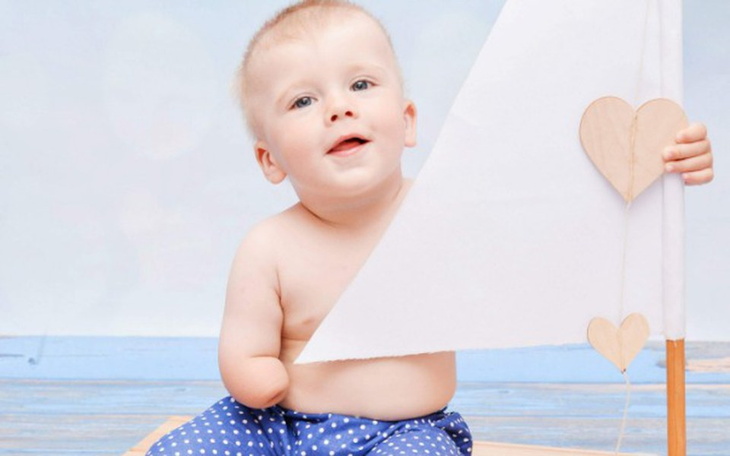 Zbiórka Bartuś potrzebuje pomocy - zdjęcie główne