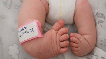 Zbiórka Leczenie stóp końsko-szpotawych - miniaturka zdjęcia