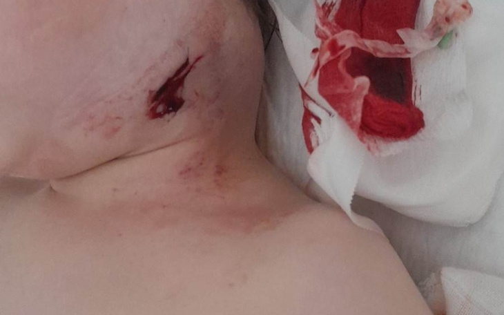 Zbiórka Witam mam na imię jula mam 18msc - zdjęcie główne