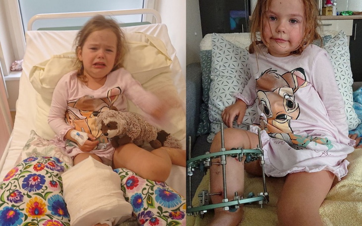 Dziecko w szpitalu, z uśmiechem, trzymające zabawkę.