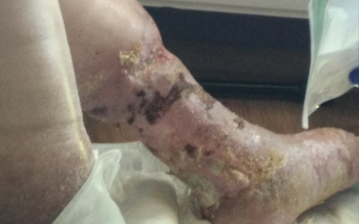 Zbiórka Chory na Raka i niewydolność żył - zdjęcie główne