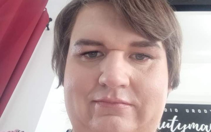 Zbiórka Na SRS korektę narządów płciow - zdjęcie główne