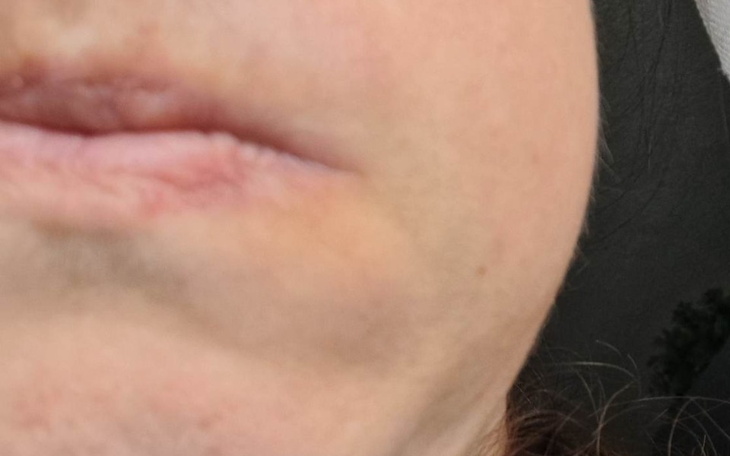 Zbiórka Leczenie dentystyczne kanałowe - zdjęcie główne