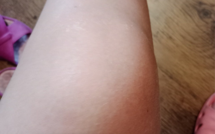 Zbiórka Dzięki operacji nie będęczuć ból - zdjęcie główne