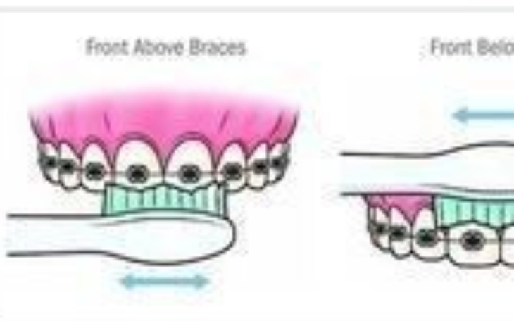 Zbiórka By życie się uśmiechnęło - zdjęcie główne