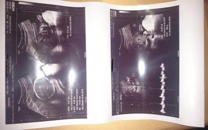 Zbiórka Pobyt nad morzem - zdjęcie główne