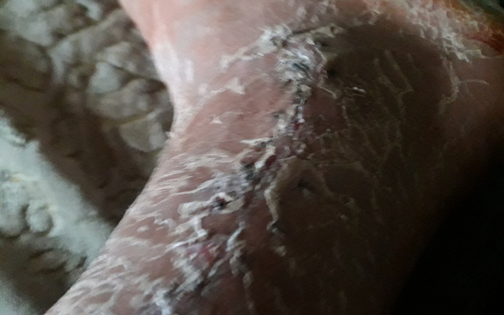 Zbiórka Na wynajecie pokoju - zdjęcie główne