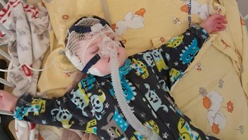 Zbiórka Asystor kaszlu dla Nikosia - miniaturka zdjęcia