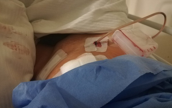 Zbiórka Endometrioza - zdjęcie główne